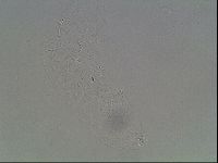 Hypsibius convergens image