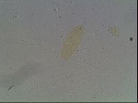 Media resource of Hypsibius convergens