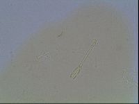 Hypsibius convergens image