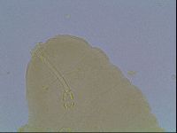 Hypsibius convergens image