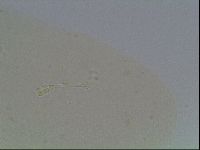 Hypsibius convergens image
