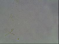 Hypsibius convergens image