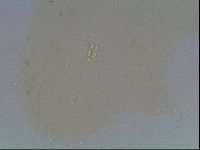 Hypsibius convergens image