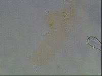 Hypsibius convergens image