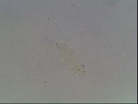 Hypsibius convergens image