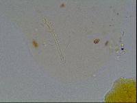 Hypsibius convergens image
