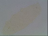 Hypsibius convergens image