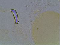Hypsibius convergens image