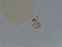 Hypsibius convergens image