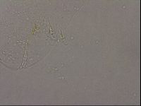 Hypsibius pallidus image