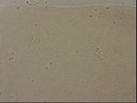 Ramazzottius oberhaeuseri image