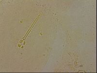 Ramazzottius oberhaeuseri image