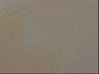 Ramazzottius oberhaeuseri image