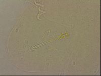 Ramazzottius oberhaeuseri image