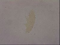 Ramazzottius oberhaeuseri image