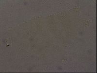 Ramazzottius oberhaeuseri image