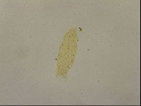Ramazzottius oberhaeuseri image