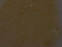 Ramazzottius oberhaeuseri image
