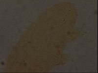 Ramazzottius oberhaeuseri image