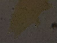Ramazzottius oberhaeuseri image
