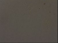 Ramazzottius oberhaeuseri image