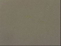 Ramazzottius oberhaeuseri image