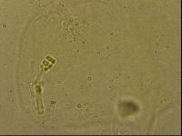 Ramazzottius oberhaeuseri image