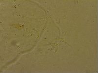 Ramazzottius oberhaeuseri image
