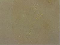 Ramazzottius oberhaeuseri image