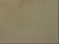 Ramazzottius oberhaeuseri image