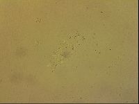Ramazzottius oberhaeuseri image