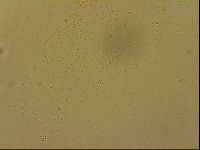 Ramazzottius oberhaeuseri image