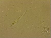 Ramazzottius oberhaeuseri image
