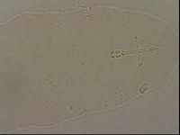 Ramazzottius oberhaeuseri image