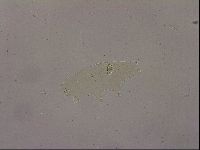 Ramazzottius oberhaeuseri image