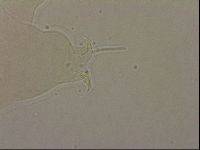 Ramazzottius oberhaeuseri image