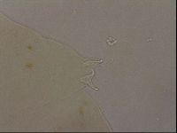 Ramazzottius oberhaeuseri image