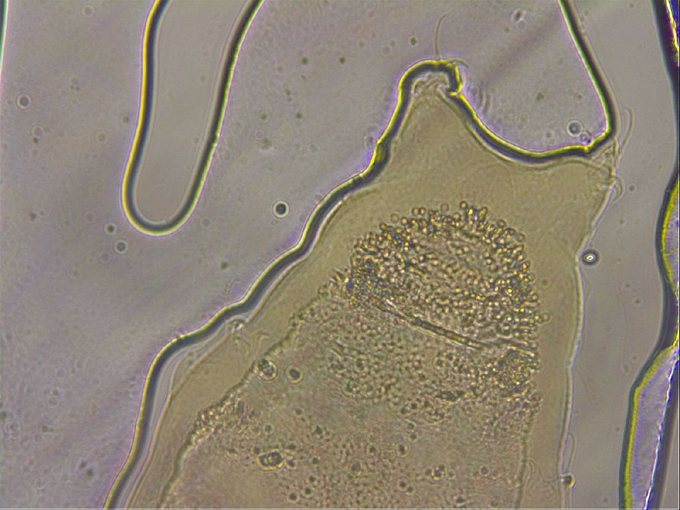 Ramazzottius oberhaeuseri image