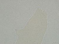 Ramazzottius oberhaeuseri image