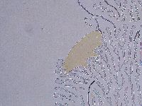 Ramazzottius oberhaeuseri image