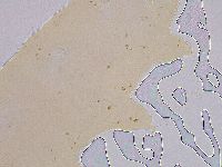 Ramazzottius oberhaeuseri image