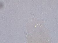 Ramazzottius oberhaeuseri image