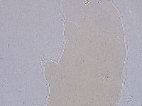 Ramazzottius oberhaeuseri image