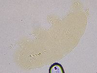 Ramazzottius oberhaeuseri image