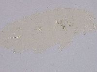 Ramazzottius oberhaeuseri image