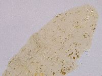 Ramazzottius oberhaeuseri image