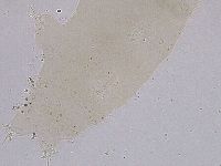 Ramazzottius oberhaeuseri image