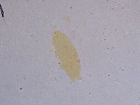 Ramazzottius oberhaeuseri image