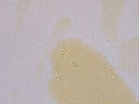 Ramazzottius oberhaeuseri image