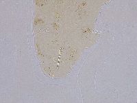 Ramazzottius oberhaeuseri image